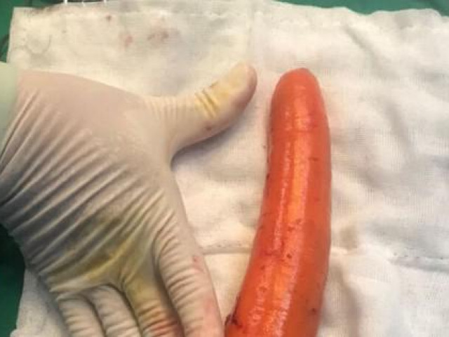 Sức khỏe đời sống - Đưa củ cà rốt dài 20 cm vào "chỗ kín", thiếu niên phải nhập viện
