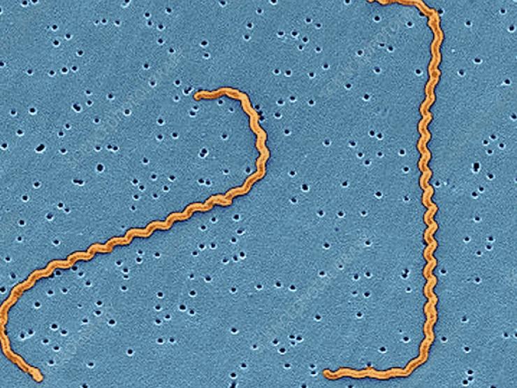 Sức khỏe đời sống - Sốt ngày thứ 3 kèm đau cơ, người đàn ông Hà Nội bị suy đa tạng