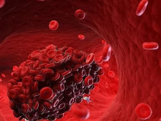 Sức khỏe đời sống - Thanh niên 22 tuổi bị nhồi máu cơ tim, đừng bỏ qua 4 dấu hiệu báo động này ở tay và chân