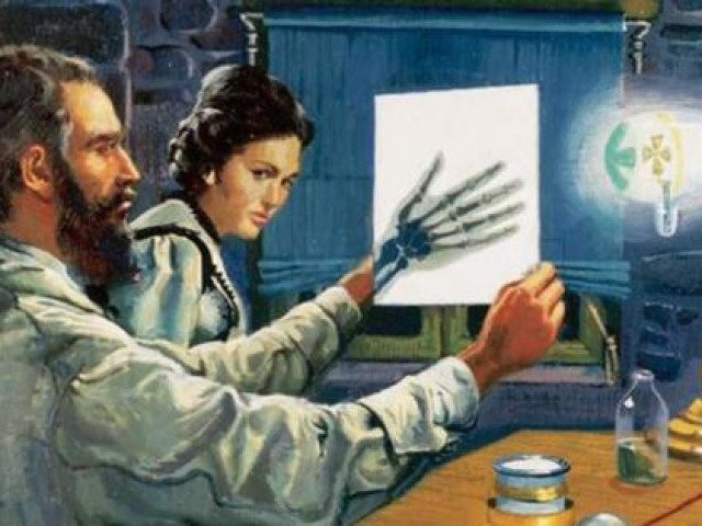 Sức khỏe đời sống - Tấm ảnh X-quang đầu tiên của nhân loại và ngành kỹ thuật hình ảnh y học