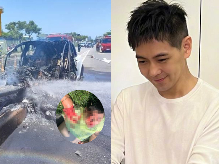 Đời sống Showbiz - Lâm Chí Dĩnh lần đầu hé lộ sự thật sau tai nạn xe kinh hoàng