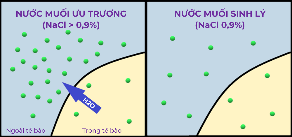 Muối ưu trương - giải pháp không kháng sinh cho hệ hô hấp của trẻ - 1