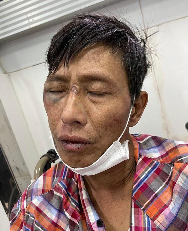 Đối tượng Vũ Văn Nguyên tại cơ quan công an. Ảnh: CAHP