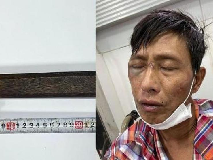 Pháp luật - Đối tượng nhiễm HIV đâm người bị thương, vung rìu chống trả cảnh sát khi bị truy bắt