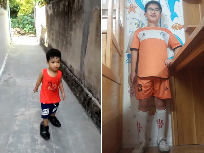 Chùm ảnh chứng minh: Giúp trẻ thấp còi “bứt phá” chiều cao không khó, quan trọng phải đúng cách! - 3