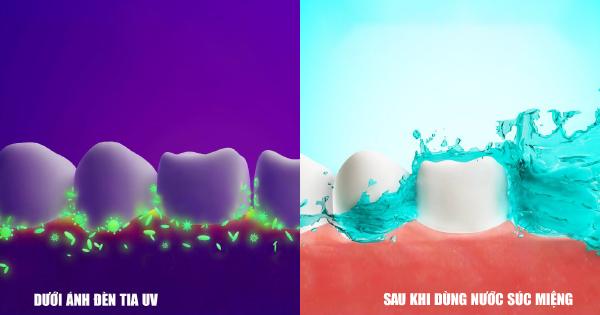 Sử dụng nước súc miệng sẽ giúp diệt khuẩn hiệu quả