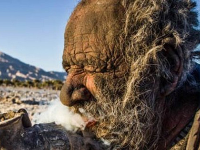 Phi thường - kỳ quặc - Người ở dơ nhất thế giới qua đời ít tháng sau khi tắm rửa