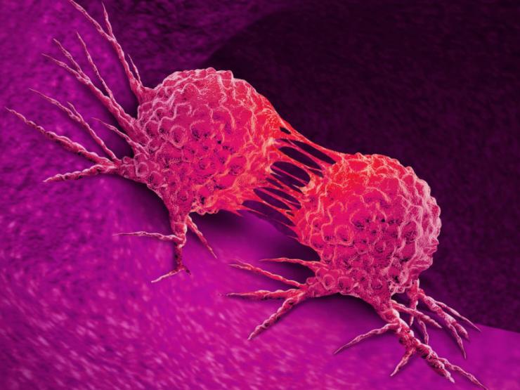 Sức khỏe đời sống - Nhiều người nhầm căn bệnh này với viêm họng, có 5 triệu chứng dưới đây phải đi khám ngay