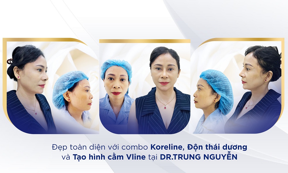 Thạc sĩ, bác sĩ Trung Nguyễn: Làm đẹp an toàn, chuẩn tỷ lệ nhân trắc khuôn mặt - 4