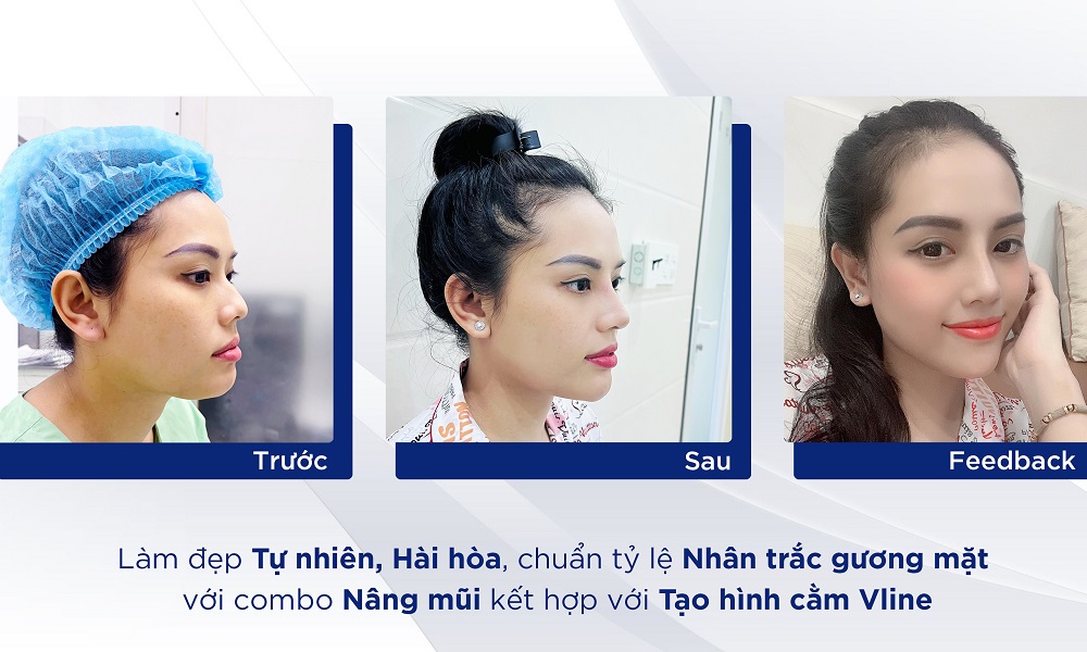 Thạc sĩ, bác sĩ Trung Nguyễn: Làm đẹp an toàn, chuẩn tỷ lệ nhân trắc khuôn mặt - 3