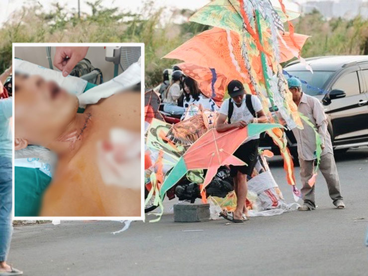 Tin tức trong ngày - Thanh niên chạy xe máy bị dây diều cứa ngang cổ