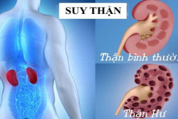 Sức khỏe đời sống - Dấu hiệu nhận biết bệnh suy thận bạn cần biết