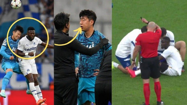 Son Heung Min dính chấn thương mắt và gò má trái khiến anh sẽ phải phẫu thuật sát thềm World Cup 2022
