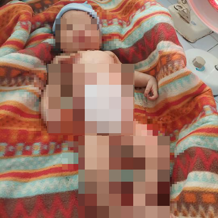 Quảng Nam: Xót xa bé sơ sinh bị bỏ rơi giữa rừng, giòi bám đầy người - 2