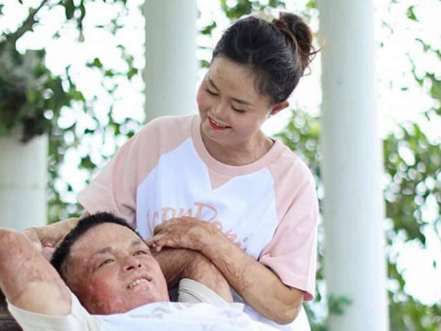 Bạn trẻ - Cuộc sống - Nạn nhân những vụ cuồng ghen tìm lại nụ cười