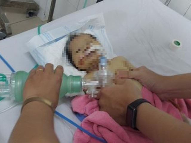 Tin tức trong ngày - Sức khỏe cháu bé bị bỏ rơi giữa rừng ở Quảng Nam chuyển biến xấu