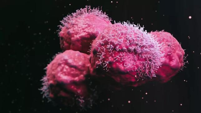 Các tế bào ung thư do có những đột biến ở gien
