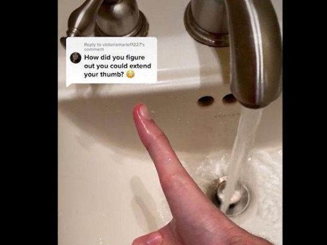 Phi thường - kỳ quặc - Thanh niên sở hữu ngón tay cái dài gần 13cm, co duỗi linh hoạt như “một cái máy”