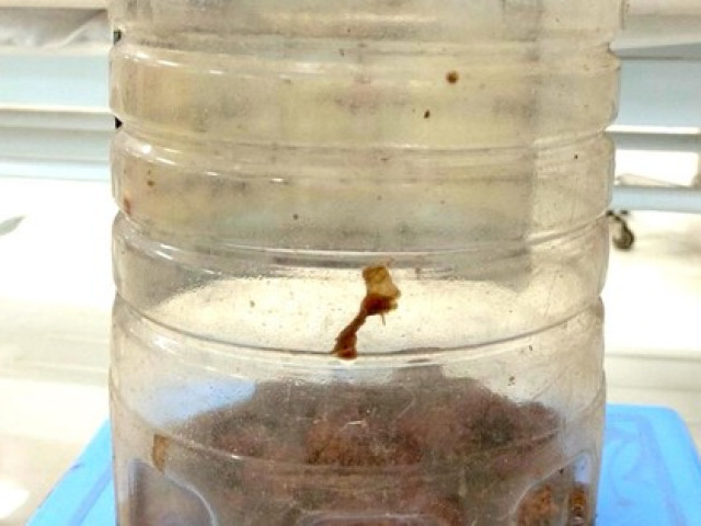 Sức khỏe đời sống - Uống rượu cà độc dược, 2 người đàn ông nhập viện cấp cứu