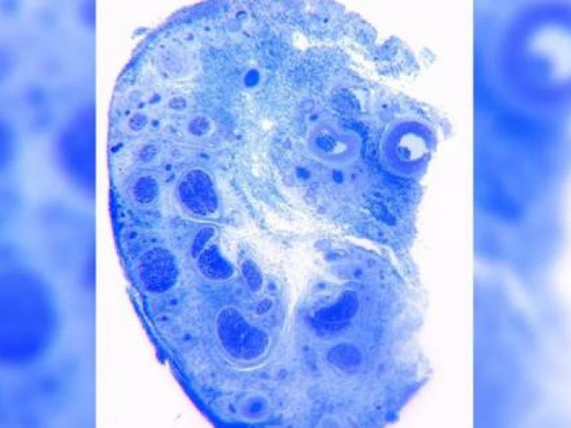 Sức khỏe đời sống - Lần đầu tiên, các nhà khoa học đã đếm được tổng cộng 10.000 sợi dây thần kinh trong "cô bé"