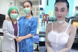 Lâm Khánh Chi sau khi tốn 5.000 USD chỉnh giọng: Nói không được, phải ghi ra giấy