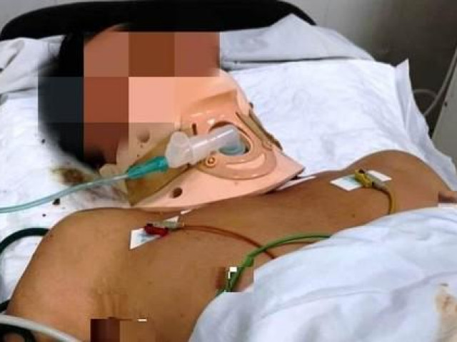 Tin tức trong ngày - Người đàn ông bị tấm tôn trên xe ba gác cắt trúng cổ