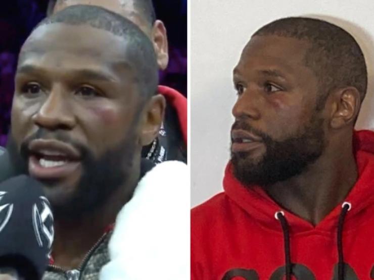 Thể thao - Mayweather bị đấm tím mắt, võ sĩ bị xử thua vì ném đối thủ xuống sàn đấu