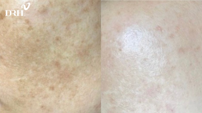 Da được căng bóng, sáng khoẻ từ sâu bên trong