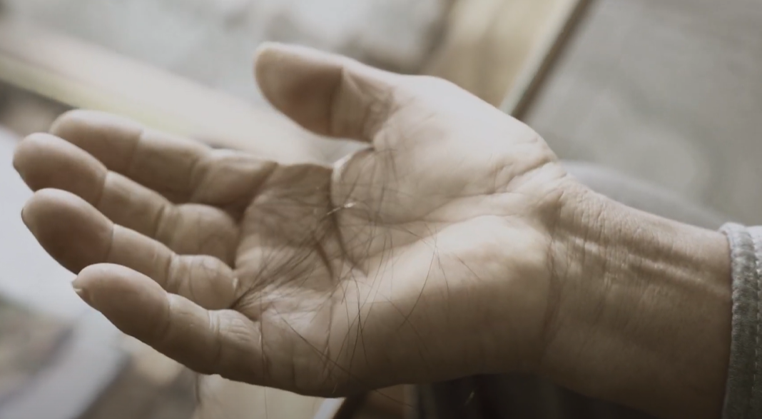 Tóc rụng trơ da đầu, chuyên gia mách bạn cách giúp tóc mọc lên dày dặn, chắc khỏe - 2