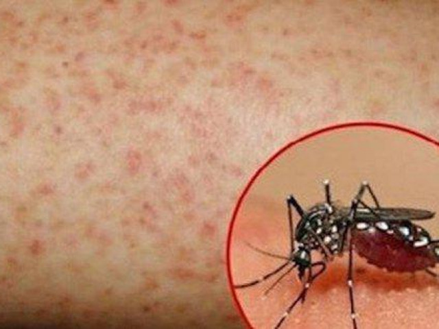 Sức khỏe đời sống - Ăn gì giúp hỗ trợ tăng tiểu cầu trong bệnh sốt xuất huyết?