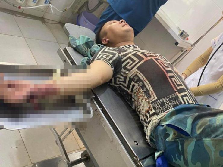 Pháp luật - Gã đàn ông "bắt sâu" trên ngực vợ hàng xóm, chém chồng trọng thương