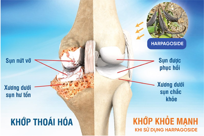 Bí ẩn cây Móng Quỷ giúp giảm đau nhức xương khớp 1000 năm trước - 4