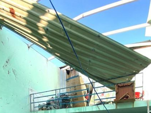 Tin tức trong ngày - Cô gái bị thương trong vụ nổ khí gas phải chuyển lên Bệnh viện Chợ Rẫy cấp cứu