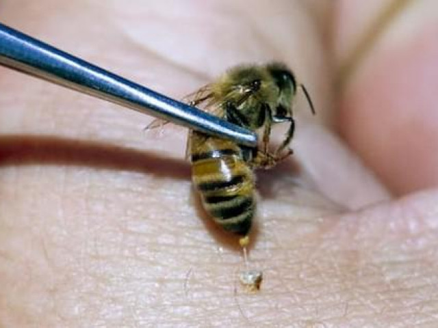 Sức khỏe đời sống - Thực hư thông tin nọc ong chữa ung thư