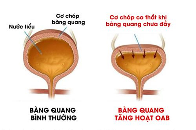 Chứng bệnh lạ, “sợ uống nước, sợ đi xa” khiến ông cụ giảm còn 35kg! - 2