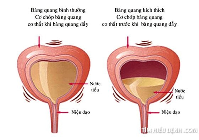 Vì sao cứ trời lạnh, mưa gió lại đi tiểu nhiều hơn? - 3