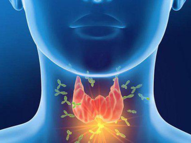 Sức khỏe đời sống - Nguyên nhân gây hội chứng suy giáp