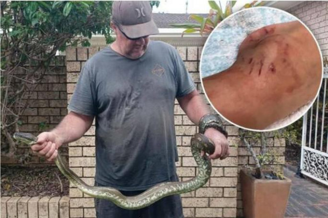 Cậu bé bị trăn cắn vào mắt cá chân. Ảnh: 3AW