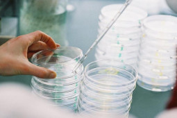 Thế giới - Điều gây lo ngại sau khi virus cổ đại gần 50.000 năm tuổi hồi sinh