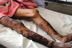 Sức khỏe đời sống - Người đàn ông bất ngờ hôn mê, nguy kịch sau mổ lợn chết