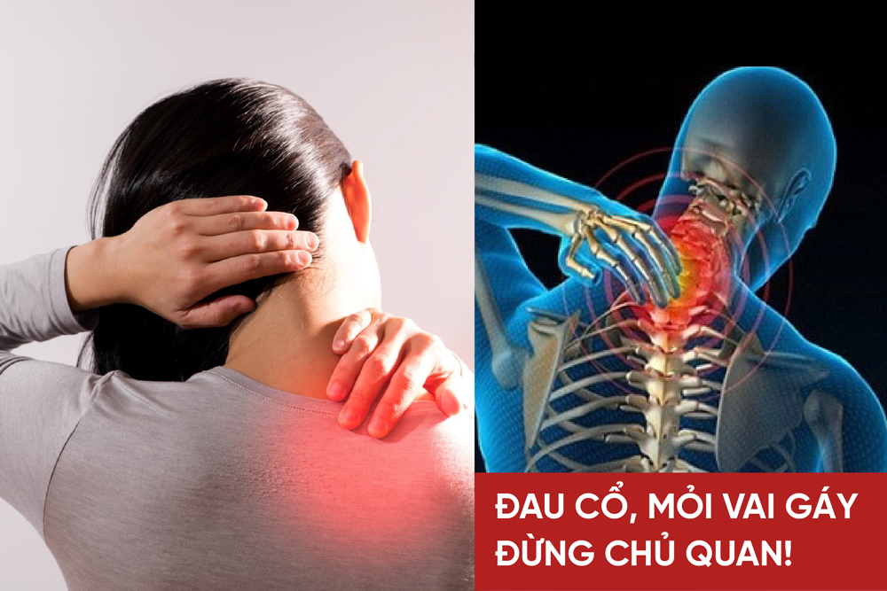 Đau mỏi cổ vai gáy, tê bì chân tay làm sao để giảm đau nhanh chóng? - 1