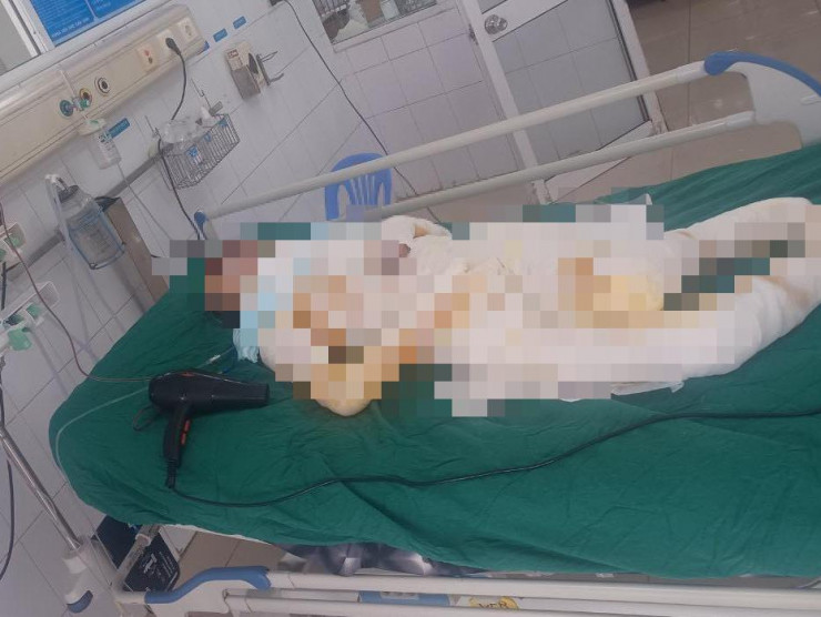 Bà Đ. - nạn nhân trong vụ 3 con gái mang xăng đốt nhà mẹ đang tiên lượng nặng