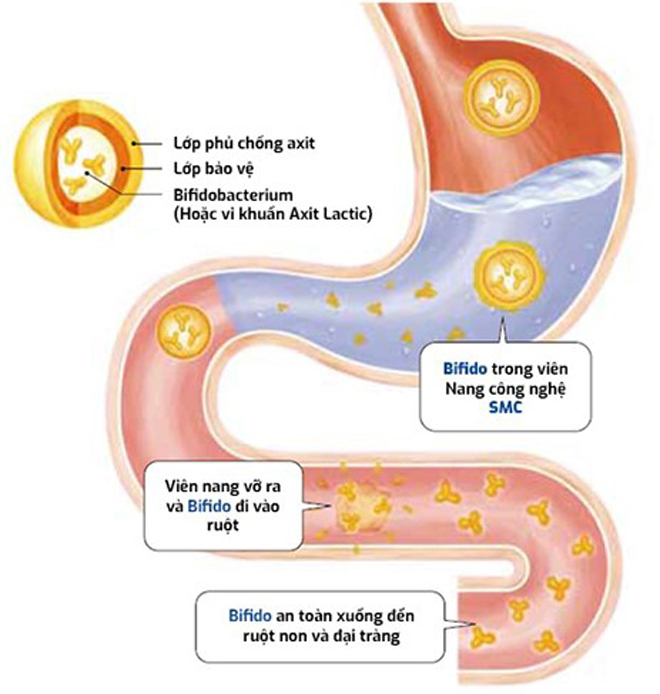 Công nghệ đột phá SMC giúp đưa lợi khuẩn sống Bifido vào tận đại tràng giúp người hội chứng ruột kích thích sống hòa bình với bệnh