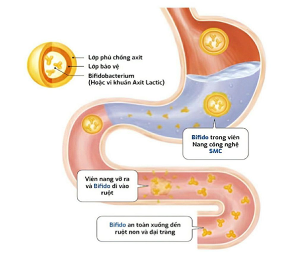 Công nghệ SMC Nhật Bản giúp người bị hội chứng ruột kích thích thoát khổ
