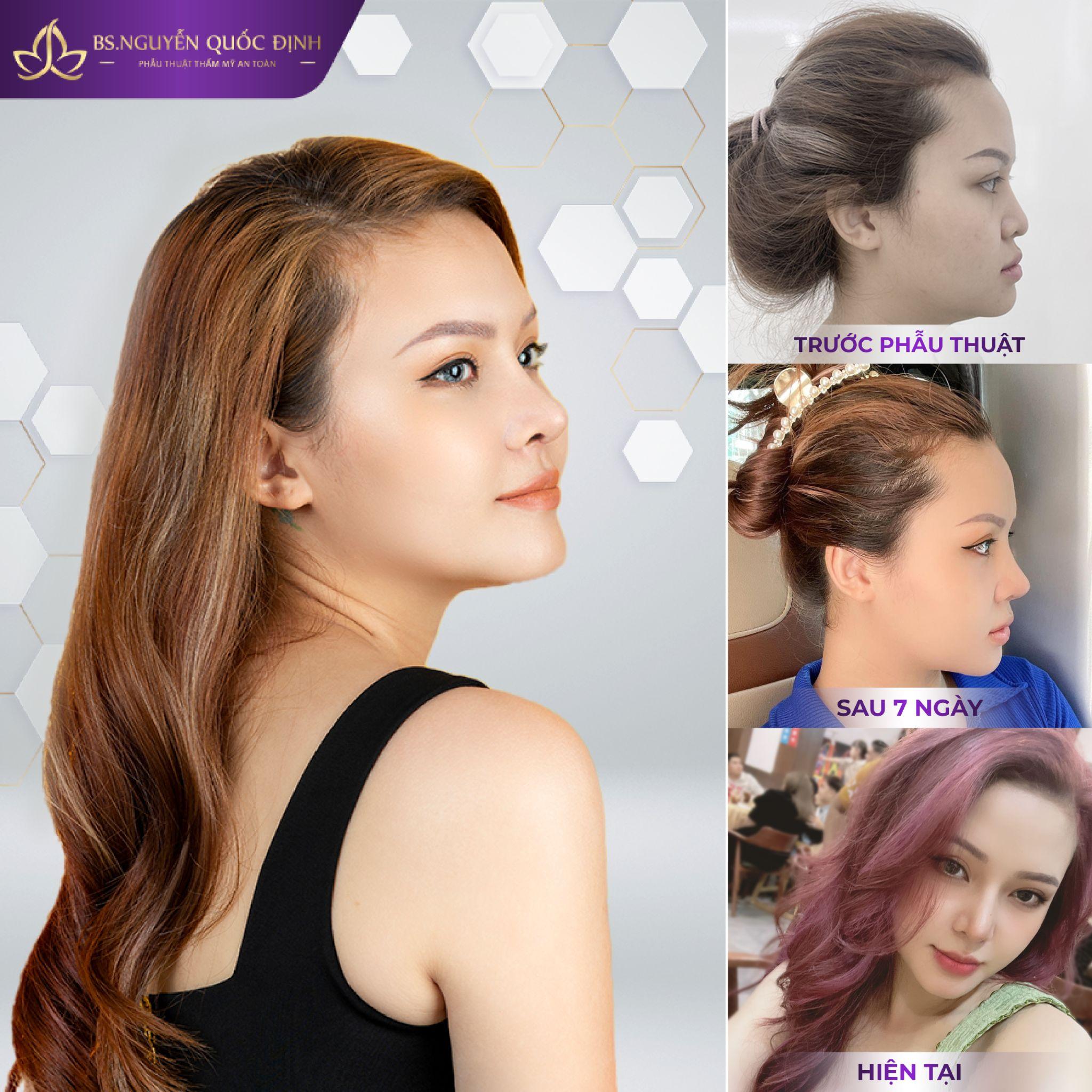 Bác sĩ Nguyễn Quốc Định - Người tân trang cho hàng ngàn nhan sắc - 6