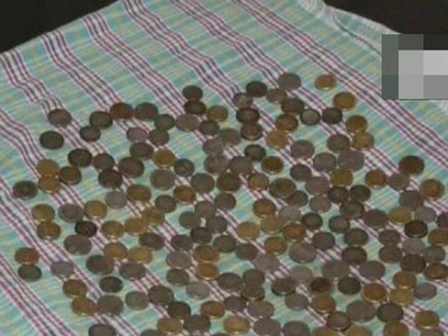 Phi thường - kỳ quặc - Bác sĩ sửng sốt phát hiện 187 đồng tiền xu trong bụng người đàn ông