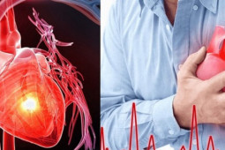 Sức khỏe đời sống - Lạnh đột ngột, người mắc bệnh tim mạch nhất định phải biết điều này để phòng bệnh tái phát