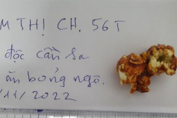 Sức khỏe đời sống - Ăn bỏng ngô con mua trên mạng, người phụ nữ ngộ độc cần sa nhập viện cấp cứu