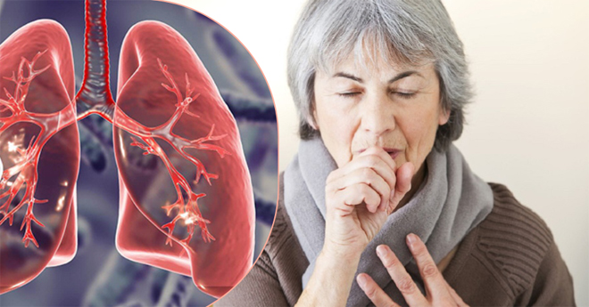 "Tạm biệt" ho đờm, đau rát họng không cần lạm dụng kháng sinh - 1