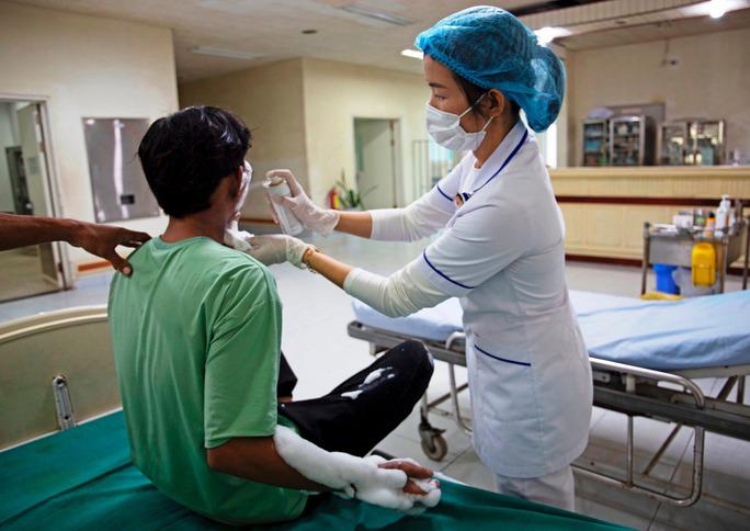 Nạn nhân bị bỏng nặng do điện thoại phát nổ